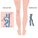 Комплект от 4 Чифта Турмалинови Термо Чорапи - TURMALUX®, komplekt ot 4 chifta turmalinovi termo chorapi turmalux